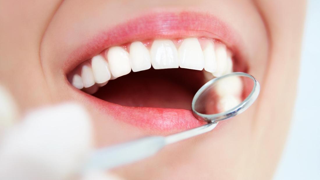 How Can I Fix Chips and Gaps in My Teeth? Encinitas CA Dentist