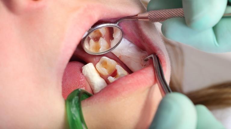 childrens dentist encinitas ca