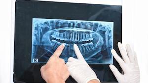 Diagnostic Dentistry | Encinitas CA Dentist