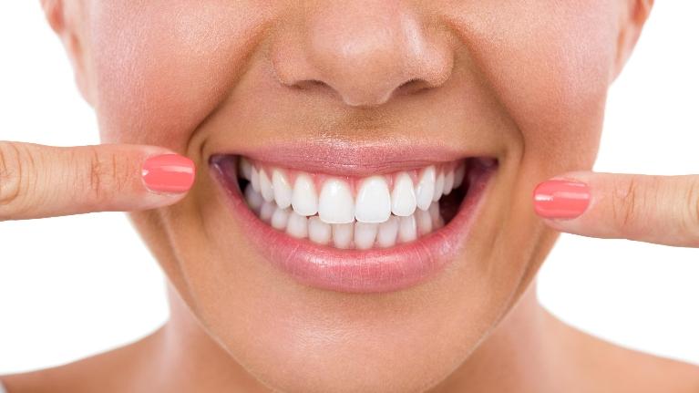 Encinitas CA Teeth Whitening