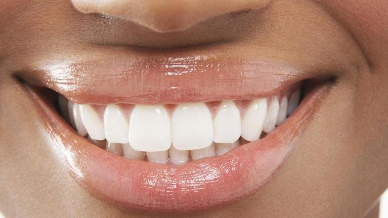 Dental Cleanings Encinitas CA