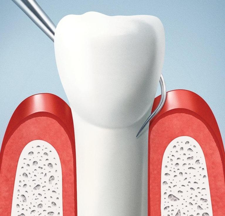 Periodontal Treatment in Encinitas CA